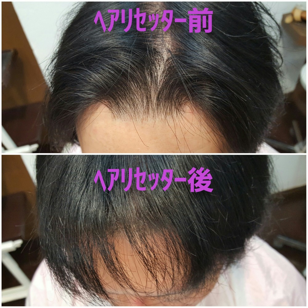 ヘアリセッターとは？ | 美容院でも床屋でもない町田のヘアサロン